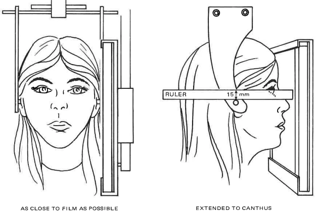 Manual Illustration